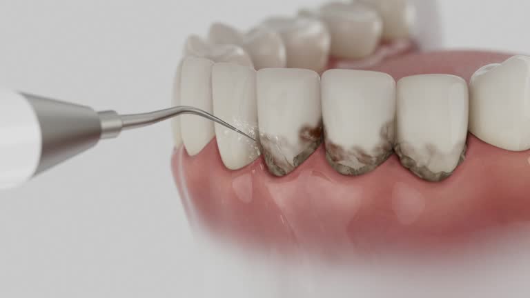 Reliable Dental Implants contractor in Jupiter Farms, FL by Smile Center Dentistry
